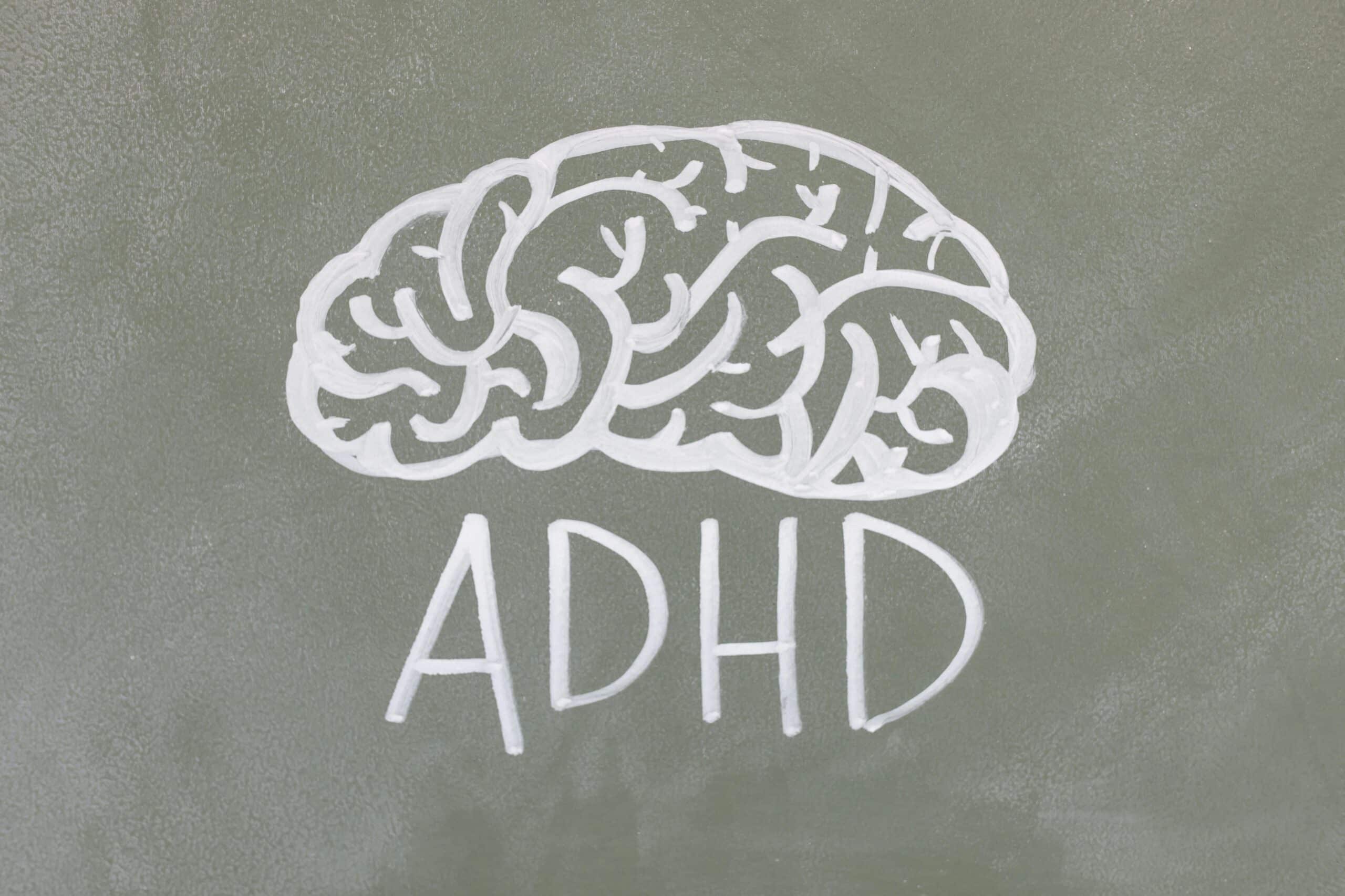 ADHD psykolog – hjelp for voksne som kjenner seg igjen i uro og kaos